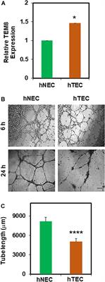 Extracellular Vesicles From Pathological Microenvironment Induce Endothelial Cell Transformation and Abnormal Angiogenesis via Modulation of TRPV4 Channels